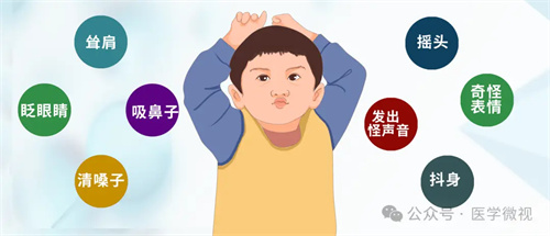 图片细节